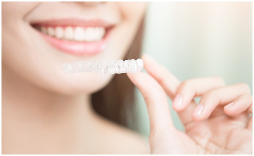 East York Clear Aligners | Dolphin Dental | East York Dentist