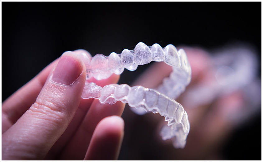 East York Clear Aligners | Dolphin Dental | East York Dentist