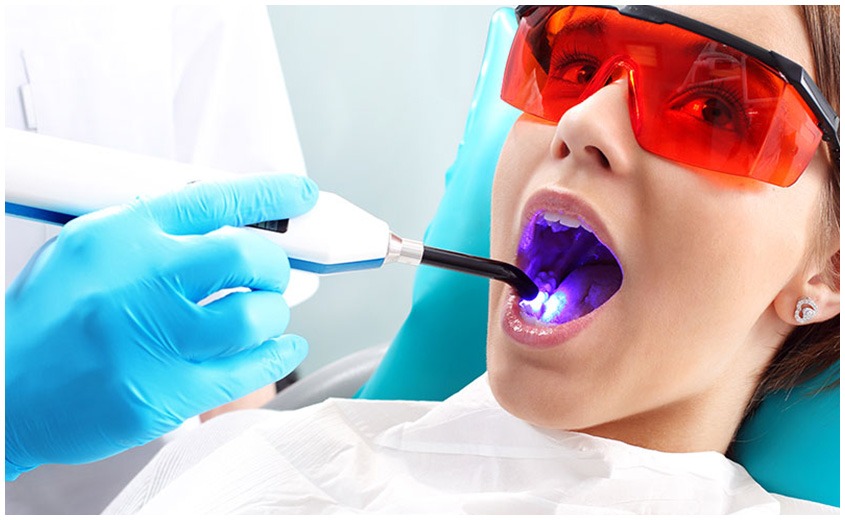 East York Cosmetic Tooth Bonding | Dolphin Dental | East York Dentist