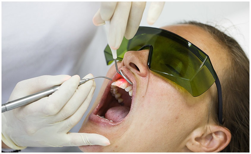 East York Laser Dental Treatment | Dolphin Dental | East York Dentist