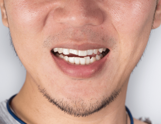East York Orthodontics | Dolphin Dental | East York Dentist