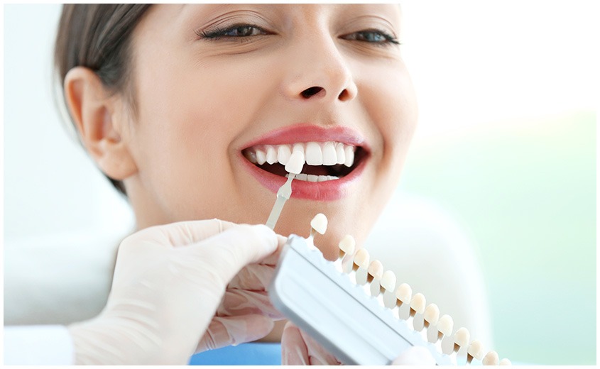 East York Porcelain Veneers | Dolphin Dental | East York Dentist