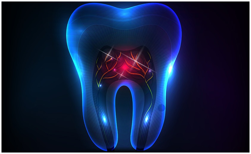 East York Root Canal Therapy | Dolphin Dental | East York Dentist